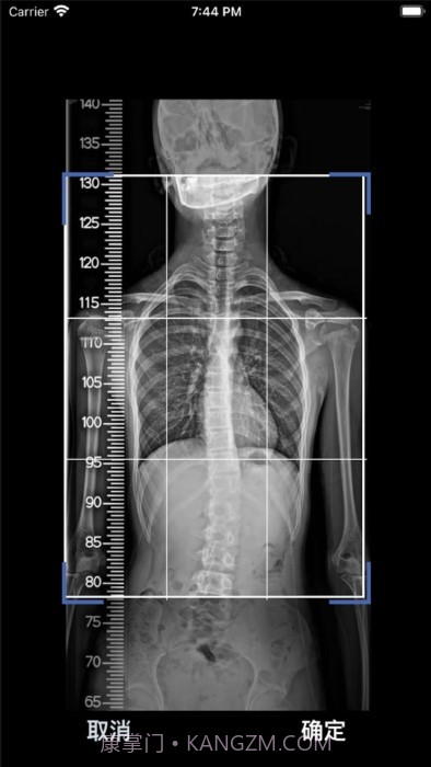 cobb角测量分析平台1.1.2截图