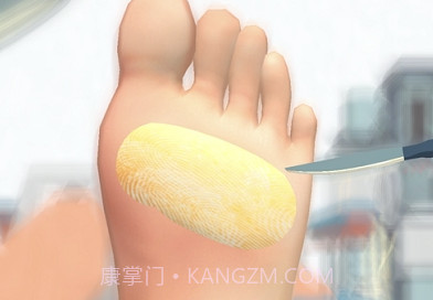 FootClinic足部诊所v1.5.13截图