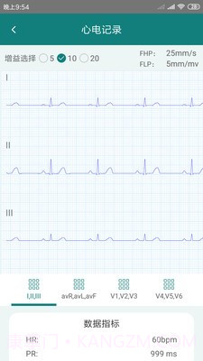 及时心电截图2 及时心电截图2