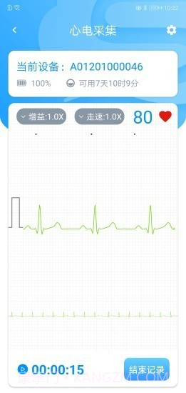 星康心电截图1 星康心电截图1