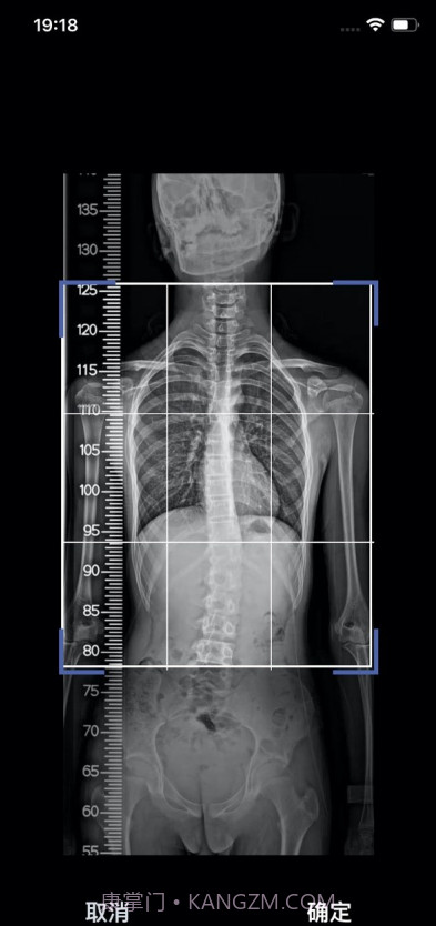 筠成矫形截图4 筠成矫形截图4