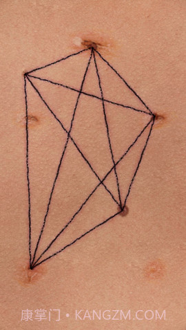 盛开之歌（Song of Bloom）截图2