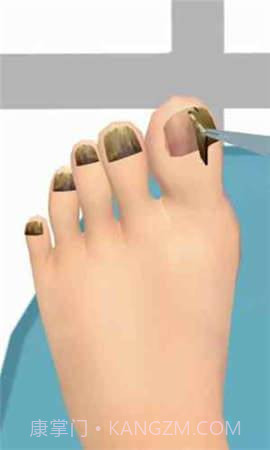 修脚模拟器截图3 修脚模拟器截图3