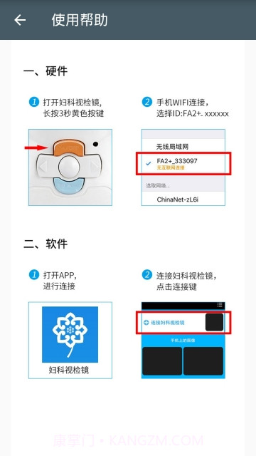 妇科视检镜截图2