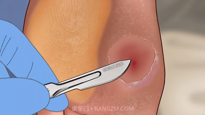 修脚足疔模拟器单机版截图3 修脚足疔模拟器单机版截图3
