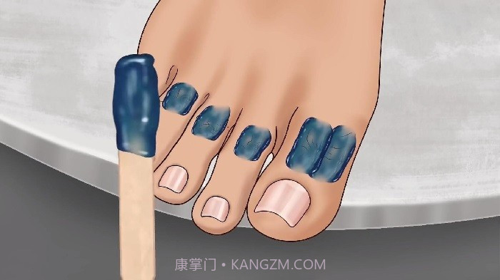 修脚足疔模拟器精简版截图2