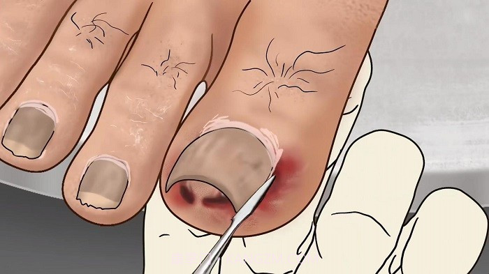 修脚足疔模拟器先行服截图1